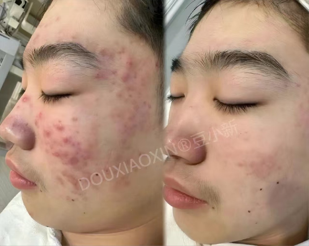 ��С�������